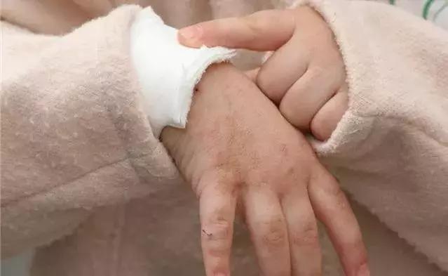 小朋友误喝火碱,7岁男孩误饮火碱