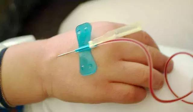 张景明讲病毒性肺炎的方子,姜治咳嗽支气管肺炎