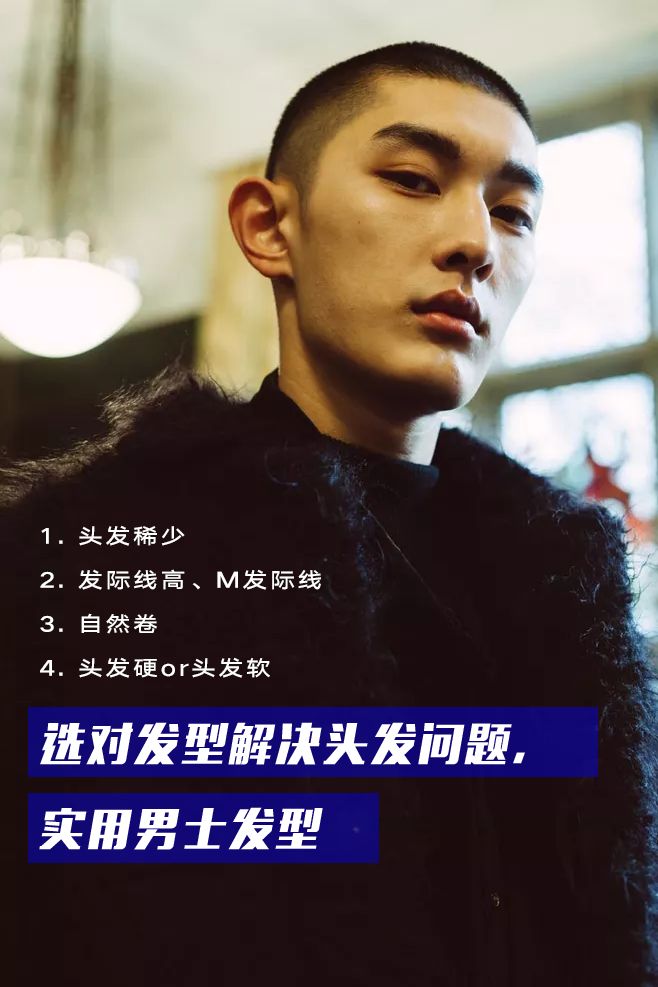 圆脸发际线高的男生适合什么发型,发际线高头发稀少发型男