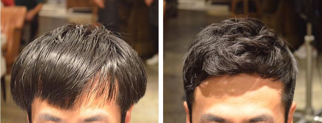 圆脸发际线高的男生适合什么发型,发际线高头发稀少发型男