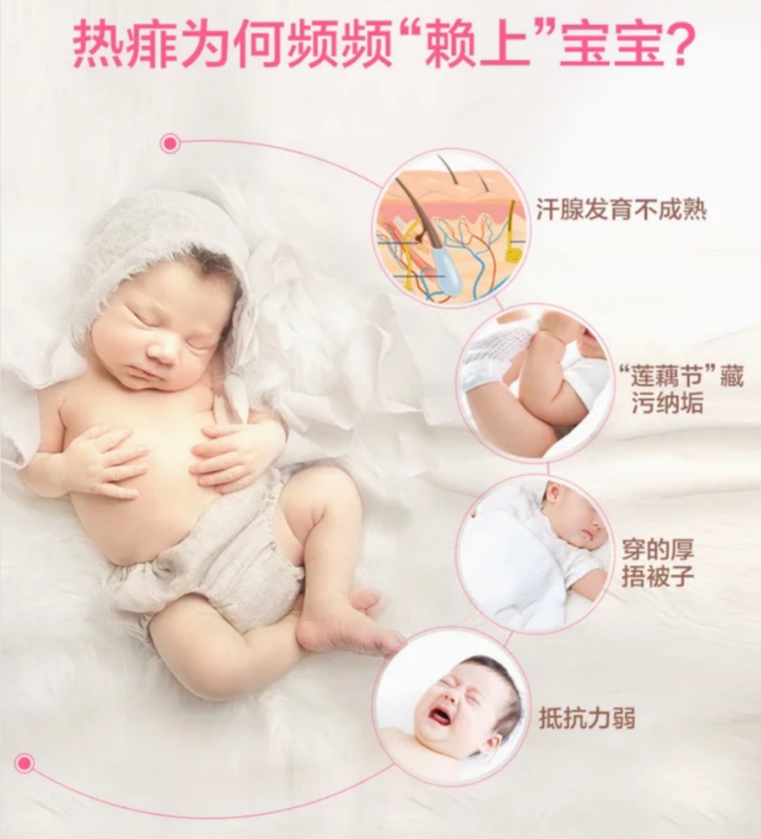 宝宝长热痱子怎么快速下去,宝宝热痱最快解决的方法