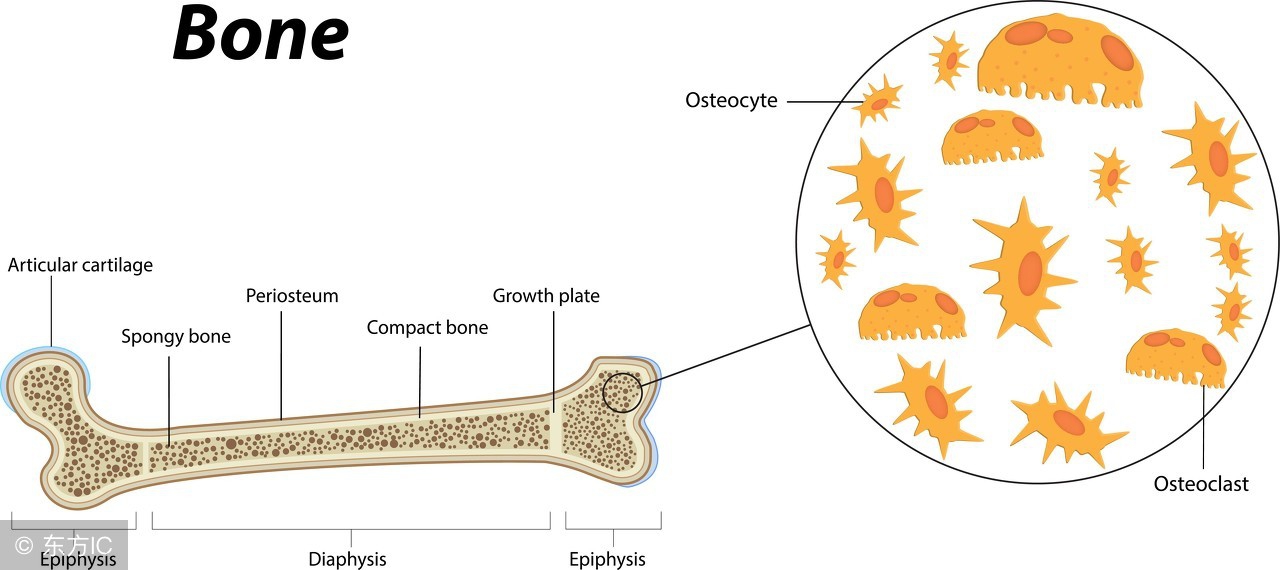 结肠癌骨转移的最佳治疗方法,结肠癌骨转移疼痛如何缓解