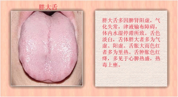 无论男女，早晨起来看看“它”，颜色越白，湿寒越重！