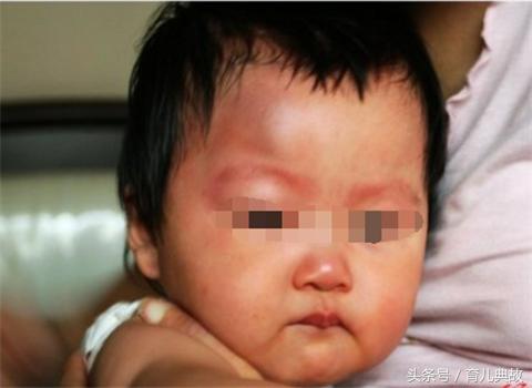 孩子被鱼刺卡喉了妈妈一定要知道,宝宝被鱼刺卡到哭了一会睡着了