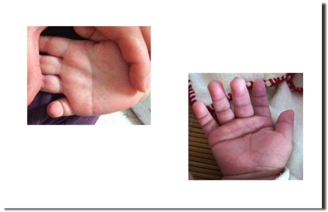 会得大病的手相掌纹,不懂中医怎么看手相