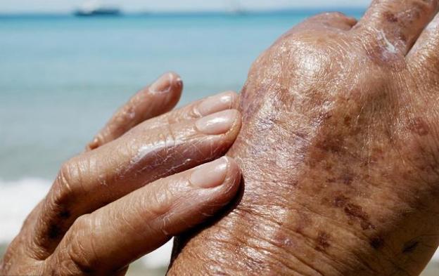 脸上色素沉着斑多暗黄怎么办,脸上斑点暗黄越来越多是什么原因