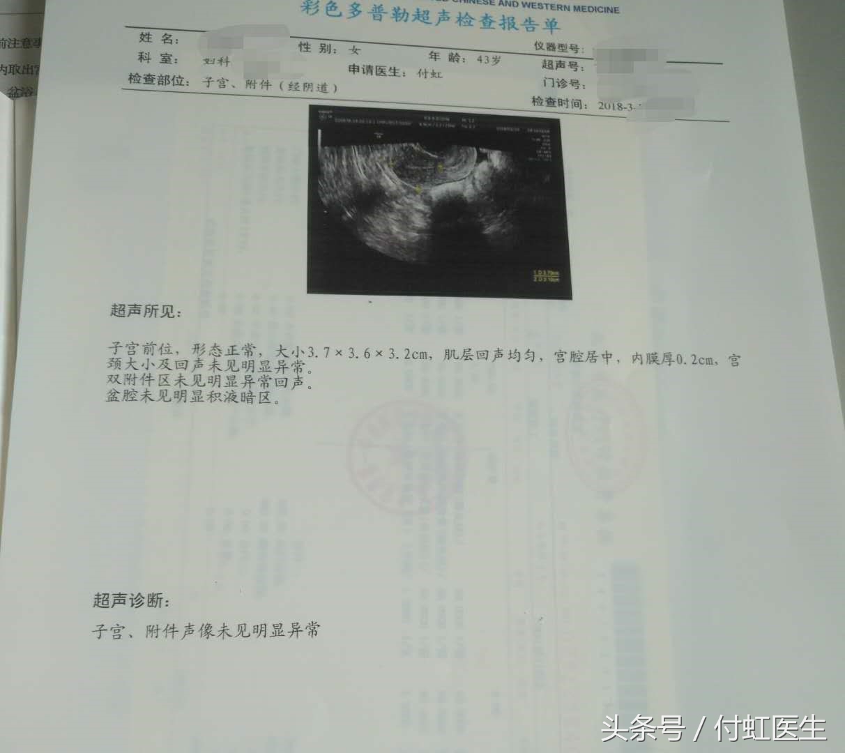 2个月不来月经还容易怀孕么,2个月不来月经是多囊吗