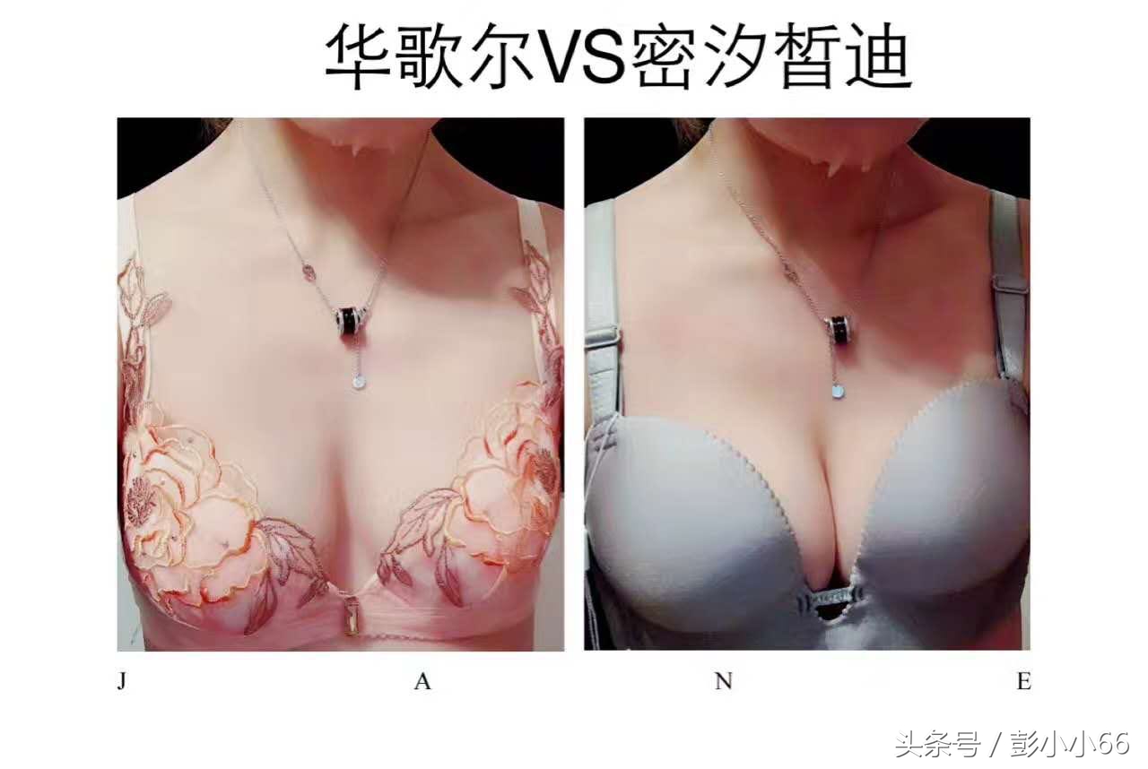 你好，你胸部外扩吗？