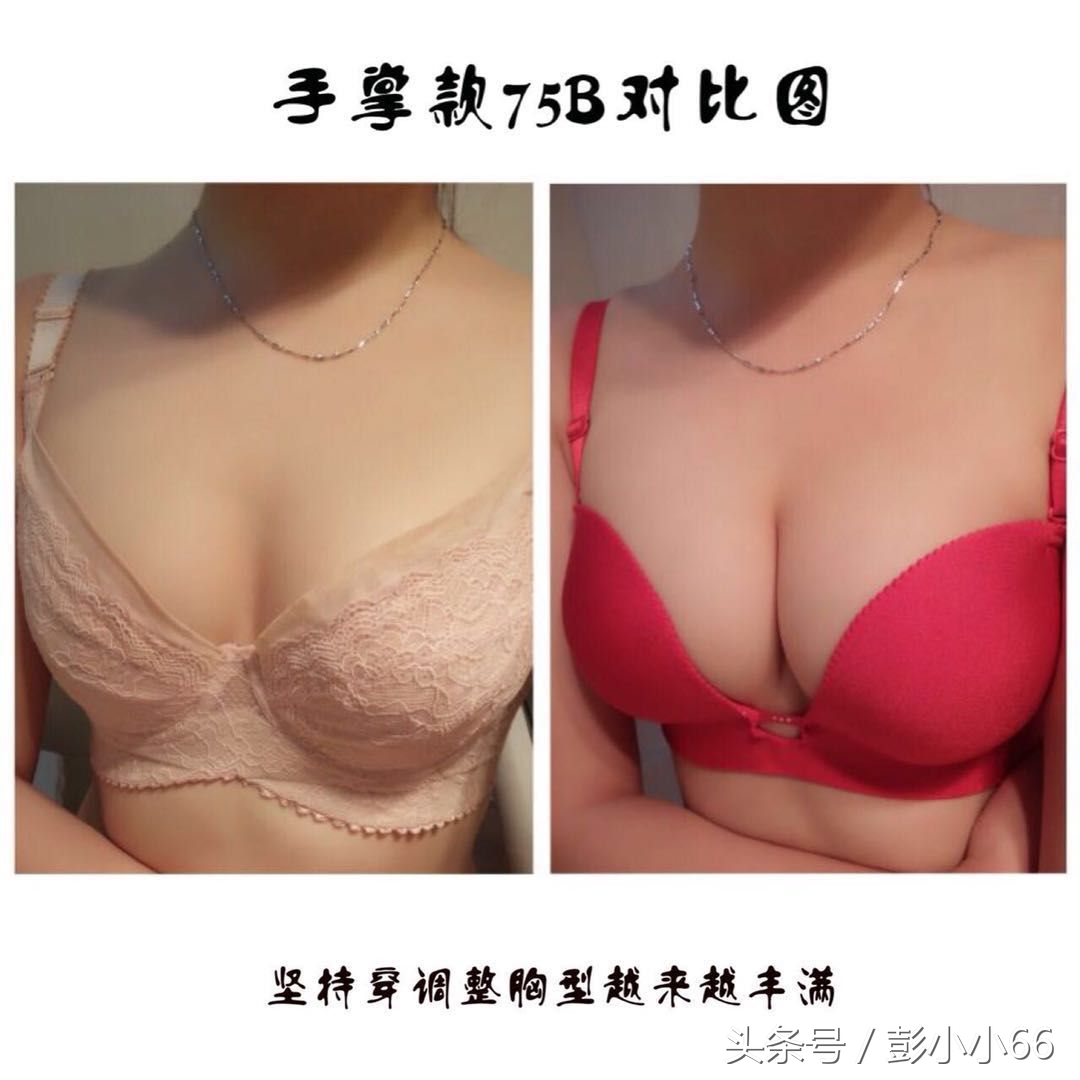 你好，你胸部外扩吗？