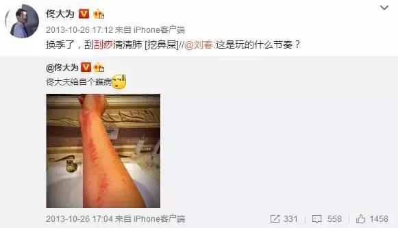 触目惊心!杨丞琳阿娇等人把刮痧过度神话,专家打脸:根本没效果