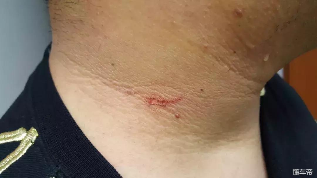 闈掑矝椴乥杞︿富澶勭綒,闈掑矝鏂拌溅鐗岄瞾b