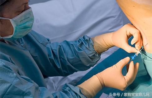 无痛分娩是什么感觉？生孩子就不疼了？我国只有10%产妇能享受