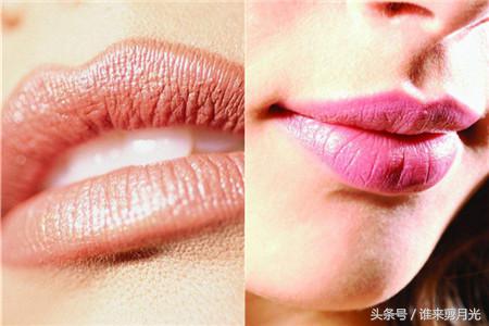 儿童嘴起泡快速消除小窍门,嘴起泡快速消除小窍门