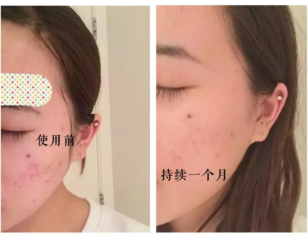 lamer什么东西最值得买,lamer值得入手吗