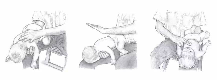 儿童误食火碱受伤,男童误吞火碱