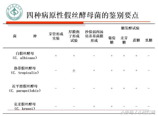 ivd基础知识大全,真菌检测要点