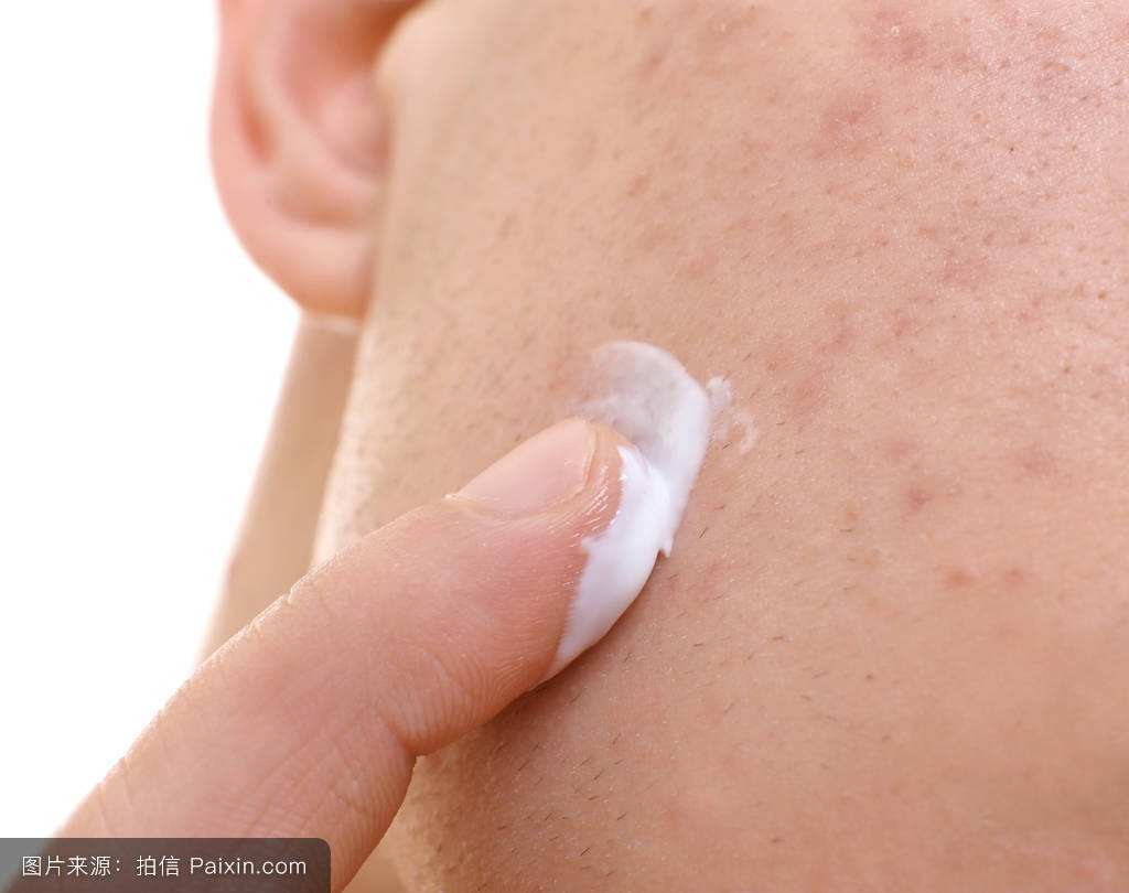 梁医生讲皮肤瘙痒怎么办,医生分享皮肤痒都用什么药抹