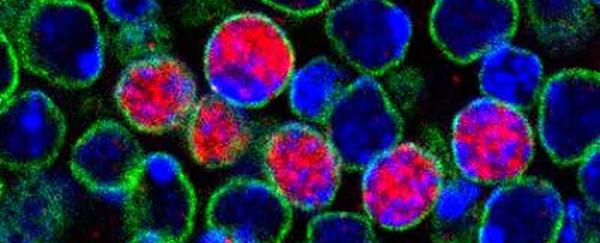 科学家诱导出人类全能干细胞,干细胞治疗脑损伤有效吗
