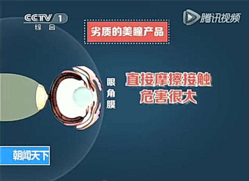 千万不要随便买美瞳,在网上买的美瞳靠谱吗