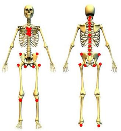 强直性脊柱炎打生物制剂越早越好,强直性脊柱炎牢记这四件事