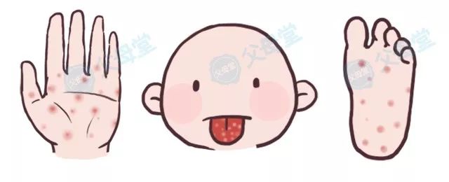 宝宝身上多出红痘痘是手足口病吗,宝宝口水痘症状