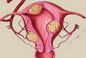 月经量变少可以怎么调理,月经量多怎样才能变少