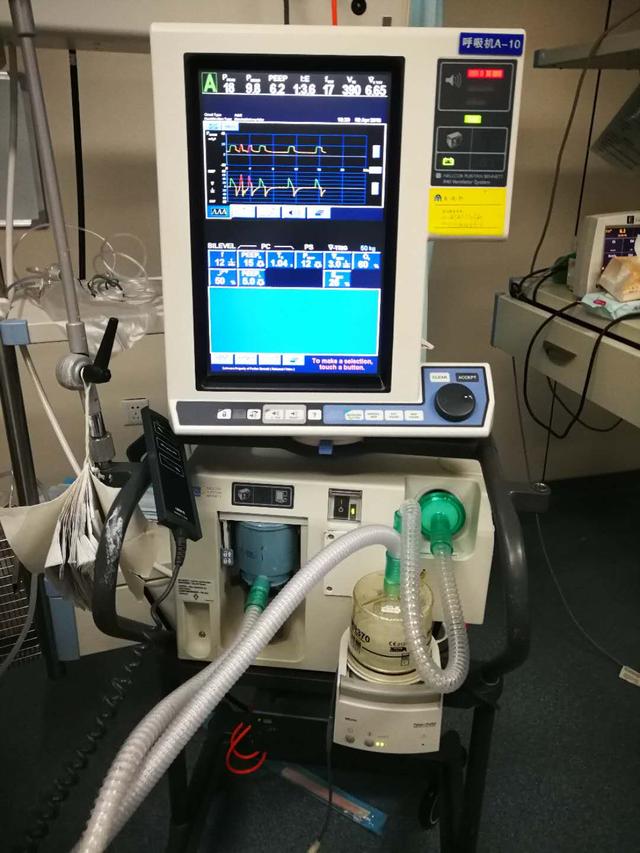 icu重症监护室呼吸机一天多少钱,icu呼吸机使用一天多少钱