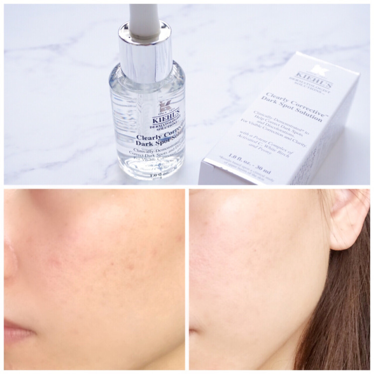 sk2的小白瓶和科颜氏淡斑精华,科颜氏美白淡斑精华sk2小灯泡