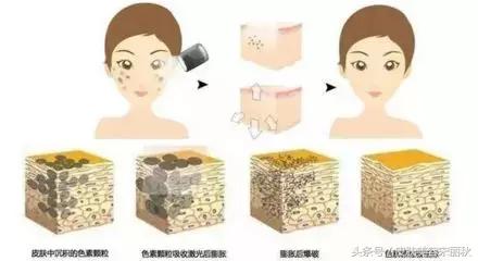 皮肤美容春夏秋冬护理方案,宋丽秋激光祛斑