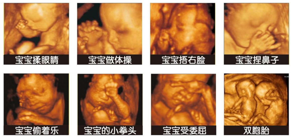 十月怀胎要闯这九关,看看孕期的你现在闯到第几关了?