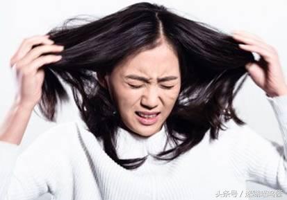 头屑多有白色癣,头屑大量真菌孢子什么情况