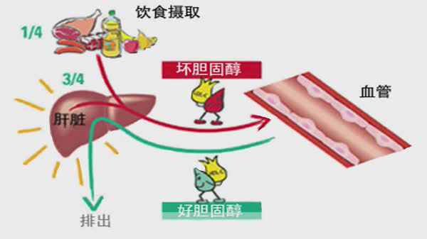 甘油三酯高为什么会造成动脉硬化,动脉硬化指数和甘油三酯高吃什么