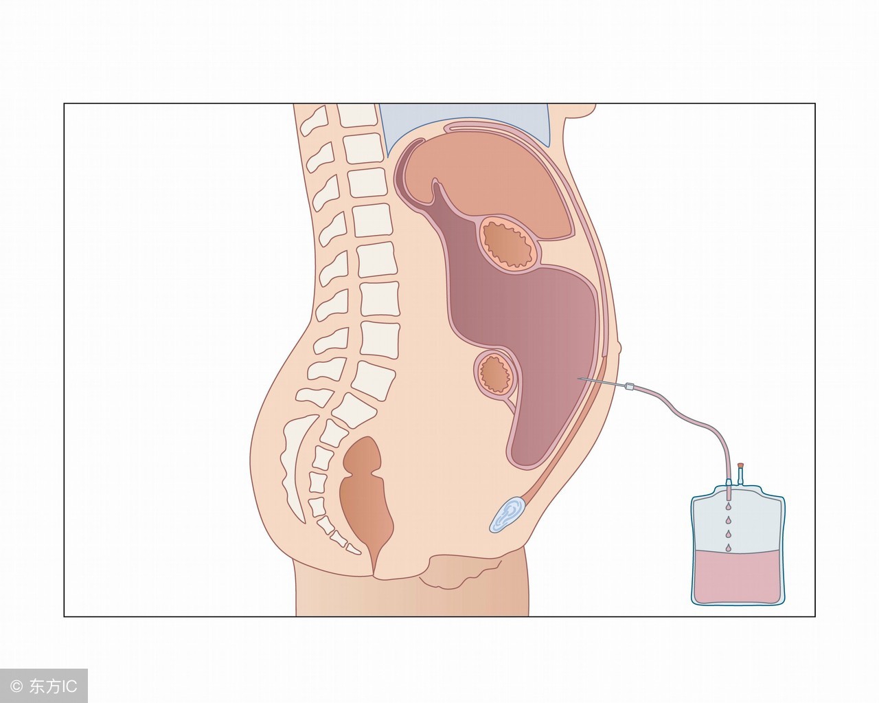 我为什么肚子老胀气？腹胀的原因有哪些？