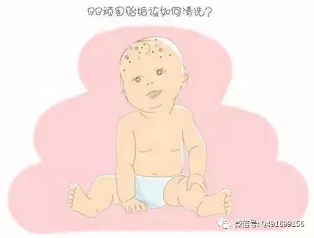 宝宝头上的胎垢该怎么清洗？
