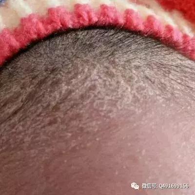 宝宝头上的胎垢该怎么清洗？