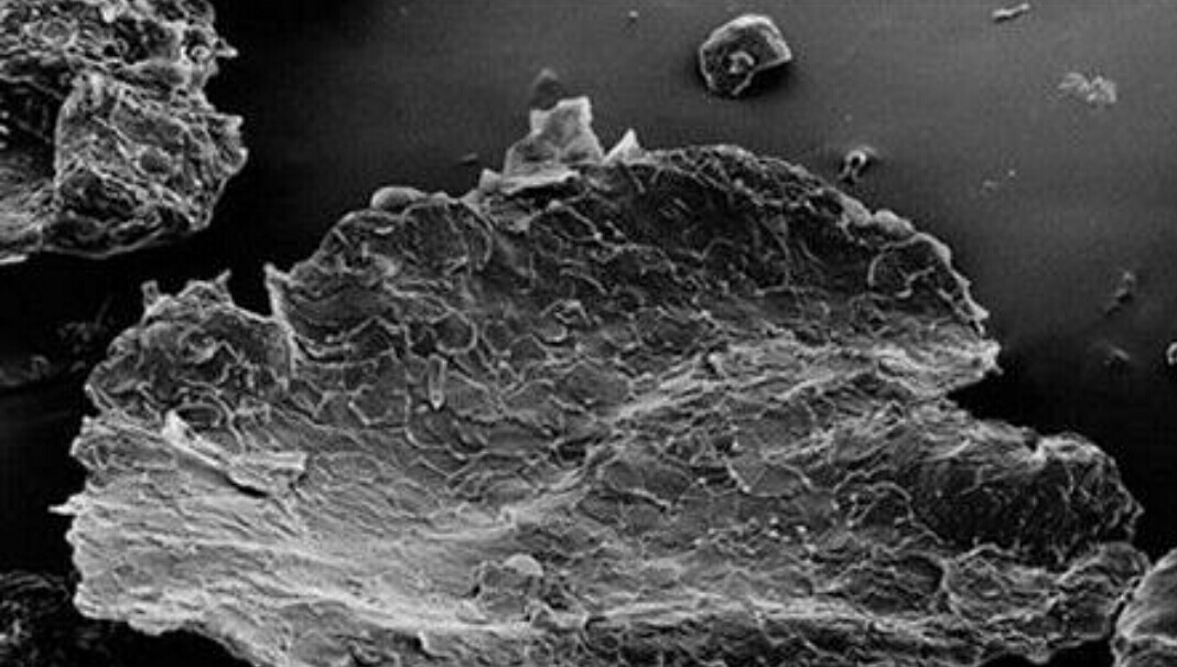 刚洗完头发头皮就抠出白泥怎么办,头发隔夜出油是什么原因