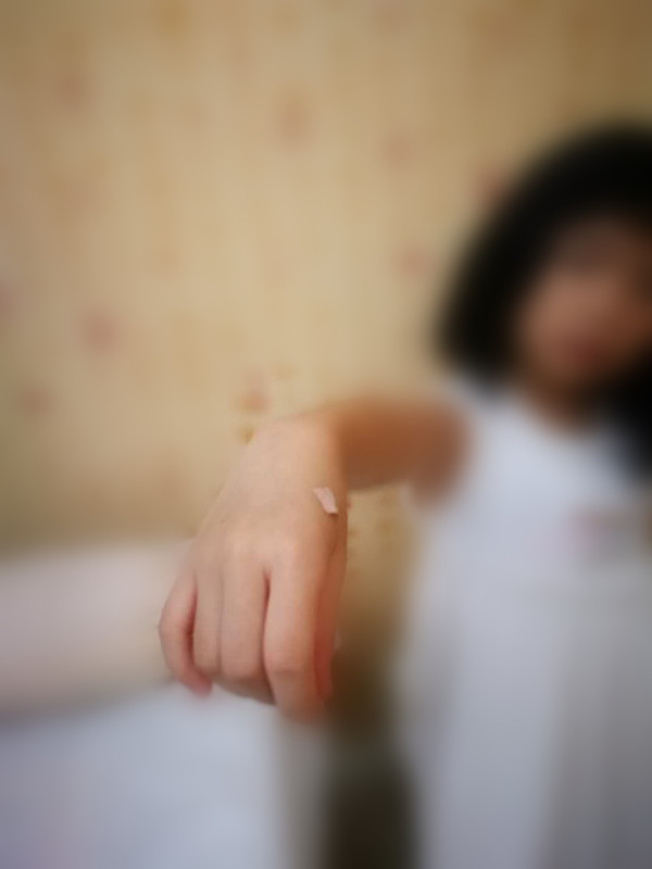 治疗孩子鼻炎贴,儿童过敏性鼻炎贴中药贴有用吗