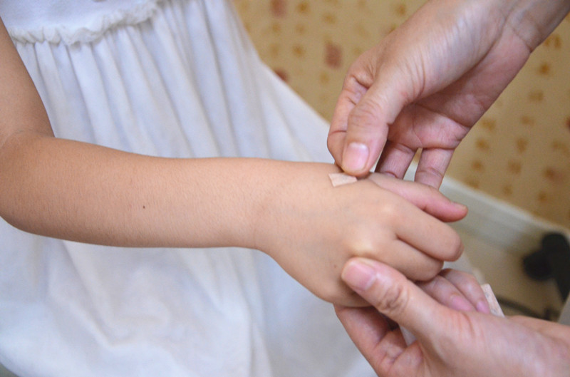 治疗孩子鼻炎贴,儿童过敏性鼻炎贴中药贴有用吗