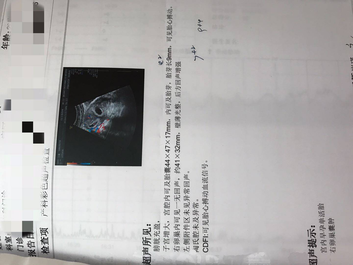 绮変笣绾︾,瀛曞绮変笣鎶曠