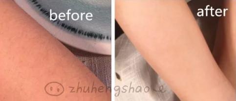 杨幂因发际线再上热搜,杨幂最近为啥上热搜