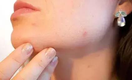 自制护肤品去皱纹效果好吗,皮肤专家教你一块钱自制护肤品