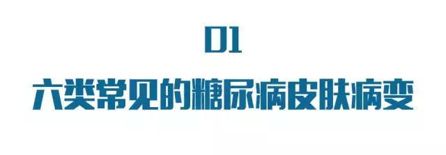 糖尿病导致的瘙痒一挠会起疙瘩吗,糖尿病皮肤瘙痒症状与荨麻疹区别