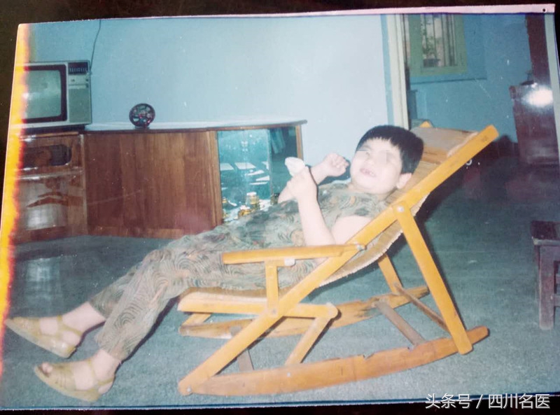 癫痫多种药物过敏,癫痫药过敏怎么治疗最好