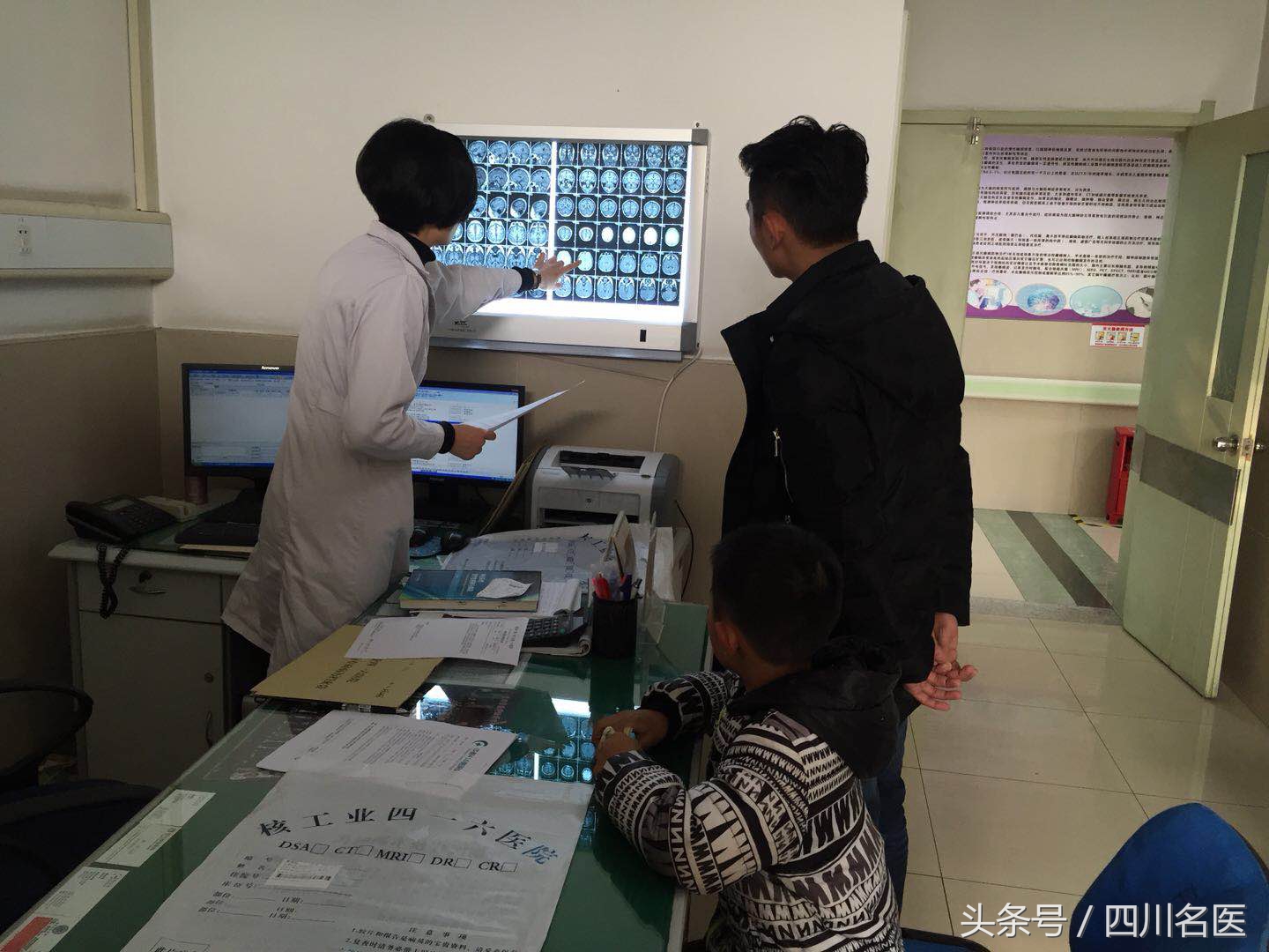 癫痫多种药物过敏,癫痫药过敏怎么治疗最好