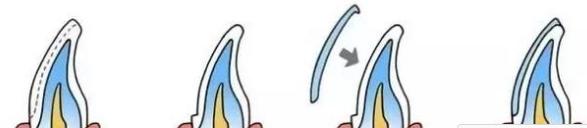 牙黄还不整齐，再美张嘴也输了你知道吗？