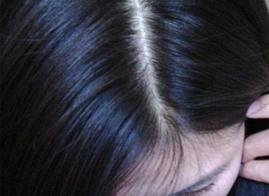 美乐家茶树精油功效,薰衣草茶树精油的功效与作用