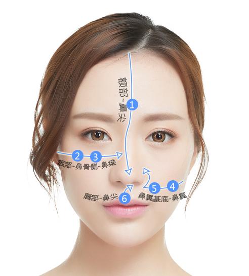 欧式鼻梁,欧美型隆鼻