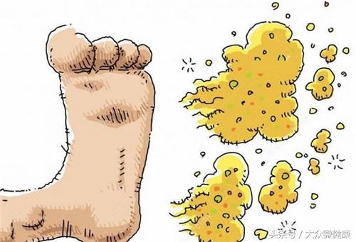 汗脚脚臭的10个小偏方,没有脚汗但是脚臭还起老皮怎么治