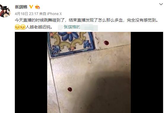 主播张琪格直播跳舞，脚出血了浑然不知，网友感言：都不容易！