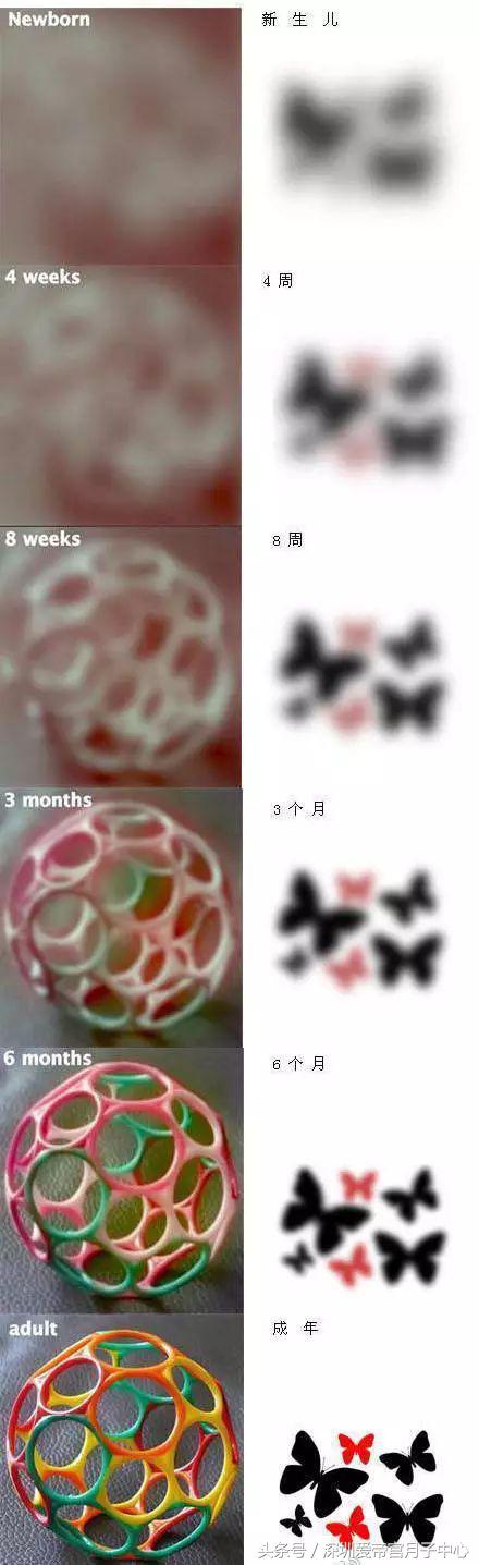 宝宝出生高度近视,婴儿出生是远视还是近视